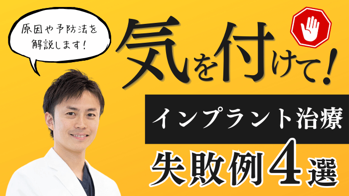 インプラント治療の代表的な失敗例4選！原因や予防法を歯科医師が解説