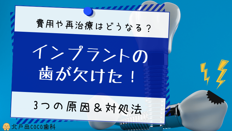 インプラントの歯が欠ける3つの原因と対処法を歯科医師が解説