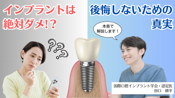 【歯科医が警鐘】インプラントは絶対ダメ！？後悔しないための真実を徹底解説。メリット・デメリット、費用、治療の流れまで、歯科医が分かりやすく解説します。不安な方は必見！