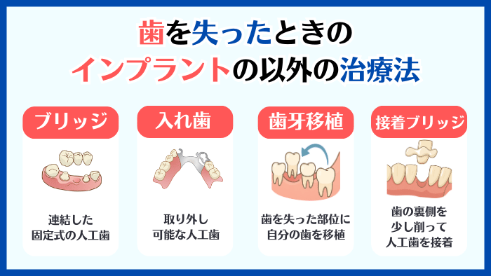 歯を失った場合の4つの治療法：インプラント、ブリッジ、入れ歯、歯牙移植、接着ブリッジの比較