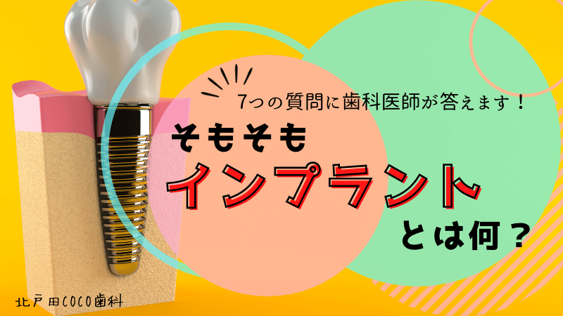 インプラントとは何か？他の治療法との比較やメリット・デメリットを解説