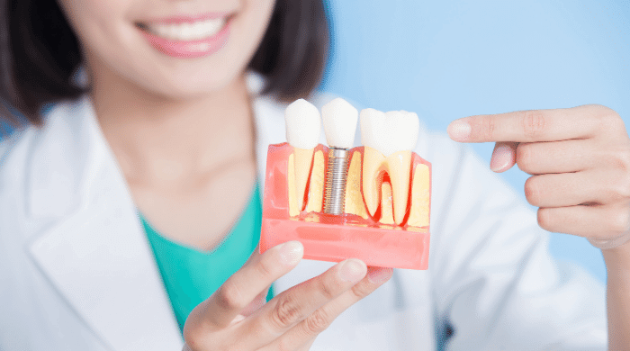 インプラント手術は痛いのか?知っておきたい2つのポイント