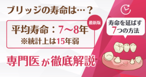 ブリッジの寿命は何年？長持ちさせる6つの方法と再治療の選択肢