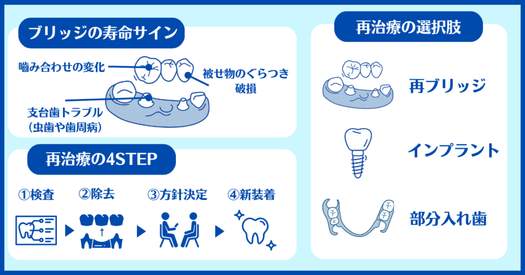 歯のブリッジの寿命サイン（噛み合わせの変化・支台歯の虫歯や歯周病・被せ物の破損）と、再治療の流れ（検査・除去・方針決定・新装着）、さらに再ブリッジ・インプラント・部分入れ歯などの選択肢を図で解説した画像