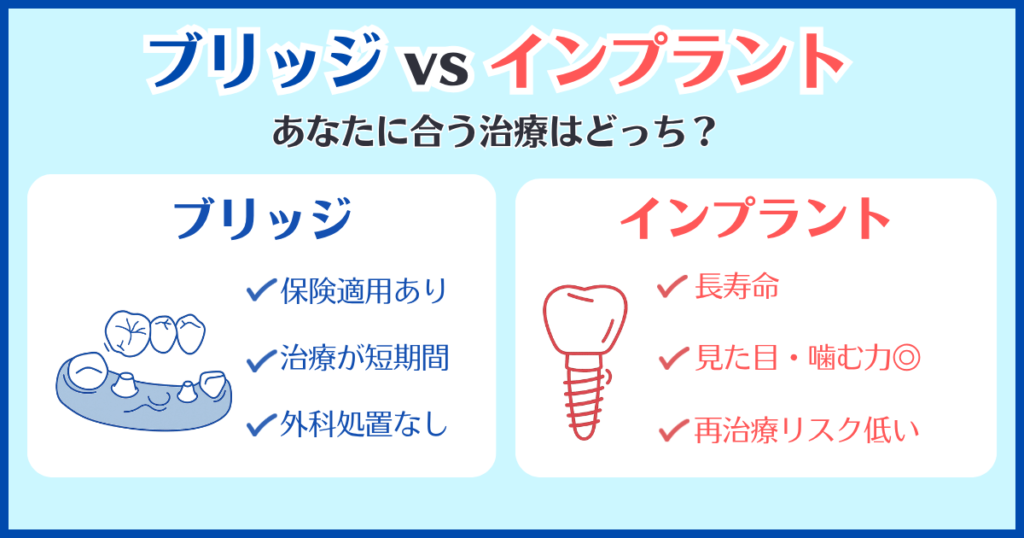 歯のブリッジとインプラントを比較した図解。ブリッジは保険適用や短期間治療がメリット、インプラントは寿命が長く再治療リスクが低いのが特徴。どちらが合うかをわかりやすく整理