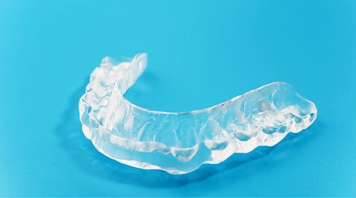 歯ぎしりや食いしばりが強い人はナイトガードを入れる