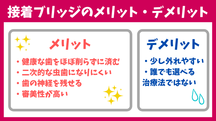 2：接着ブリッジのメリット・デメリット