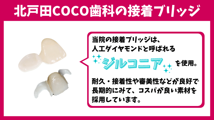 4：当院の接着ブリッジの特徴