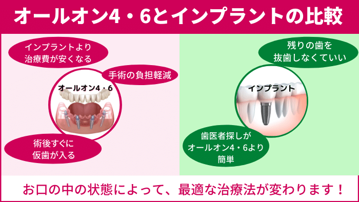 【インプラントと比較】オールオン4・6のメリット・デメリット