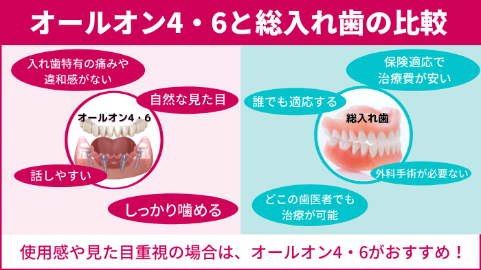 【総入れ歯と比較】オールオン4・6のメリット・デメリット
