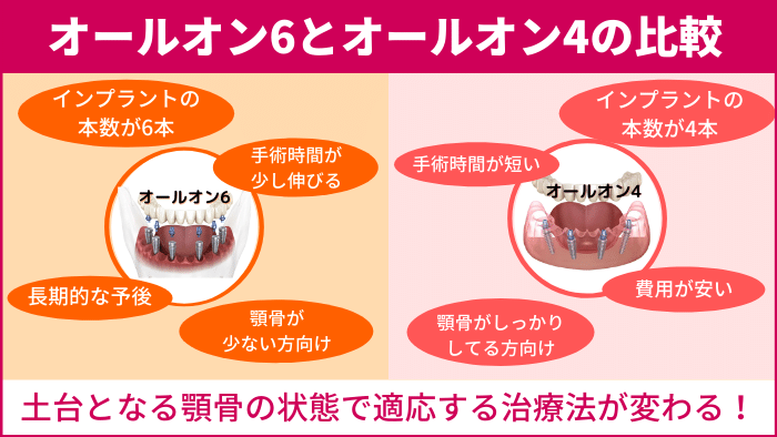 オールオン6とは？オールオン4との違い
