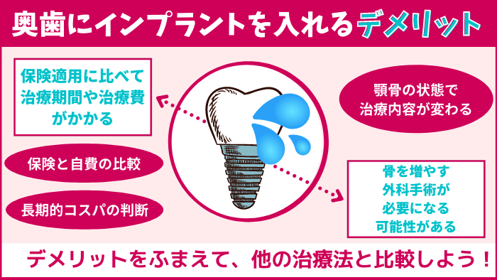 奥歯にインプラントを入れる3つのデメリット