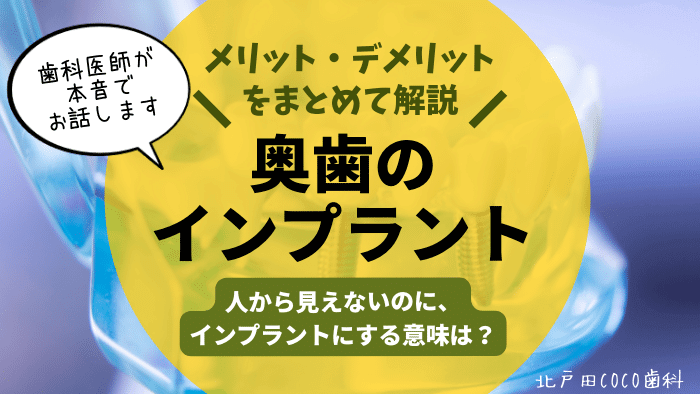 奥歯のインプラント治療のメリット・デメリット9選！歯医者の選び方も解説