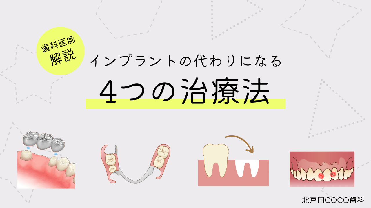 インプラントに代わる治療はある？4つの選択肢を歯科医師が徹底解説