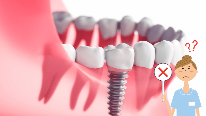 老後を考えた際のインプラントのデメリットは大きい？