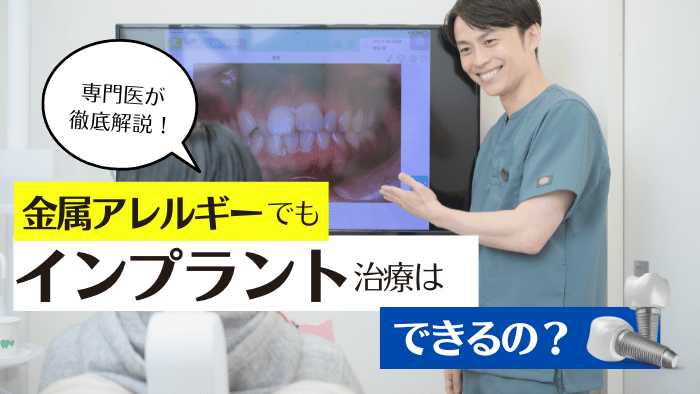 金属アレルギーでもインプラントはできる?専門医が解説!