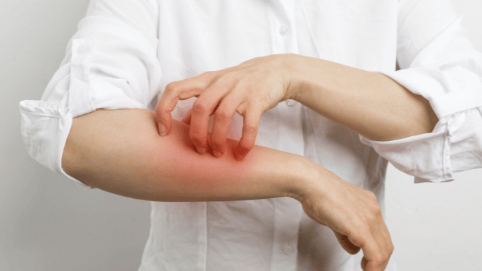 そもそも金属アレルギーとは?原因や症状