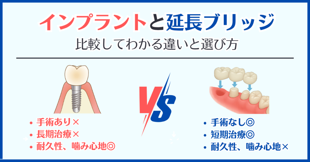 	延長ブリッジとインプラントの違いを比較した図解。手術の有無・治療期間・耐久性・噛み心地の違いをわかりやすく表示