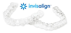 インビザライン とは