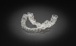 インビザライン とは