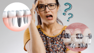 インプラント矯正とは？2つの治療法