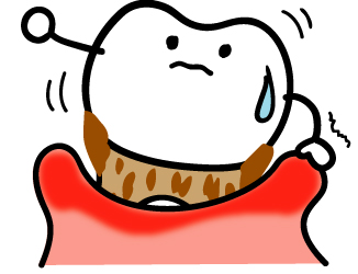 インビザライン 歯周病