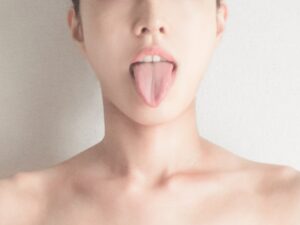 インビザライン MFT