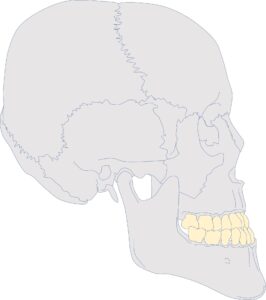 インビザライン しゃくれ