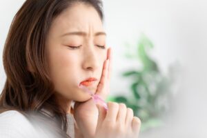 インビザライン ホワイトニング