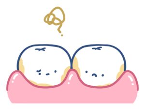 インビザライン 歯肉炎