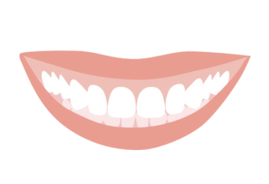 インビザライン  過蓋咬合