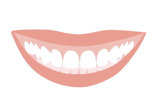 インビザライン ガミースマイル