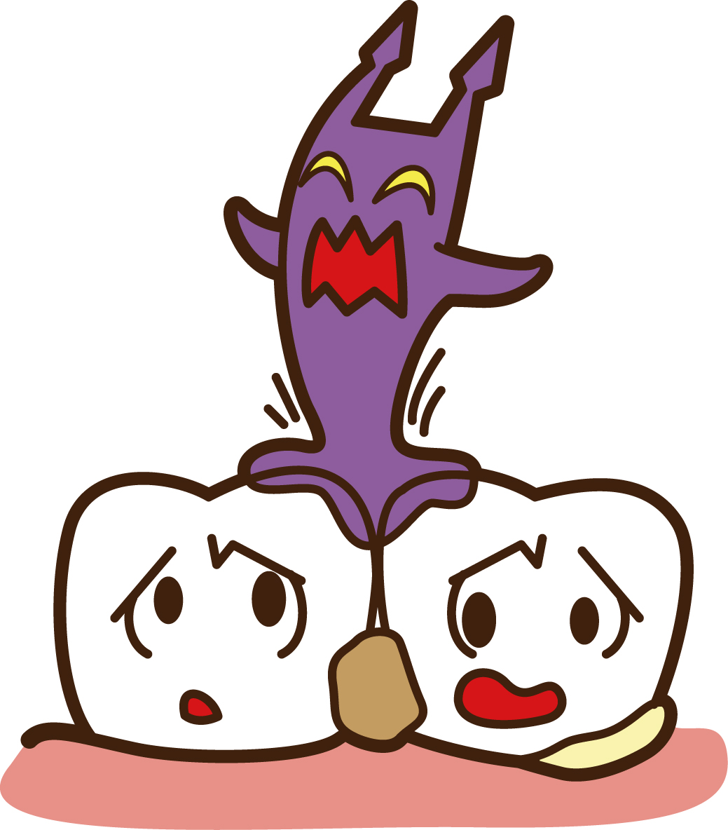 インビザライン プラーク