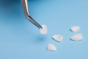 インビザライン ラミネートベニア