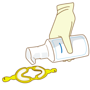 インビザライン フッ素