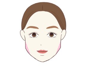 インビザライン エラ張り