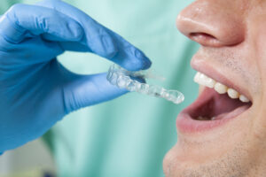 インビザライン 浮く