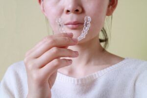 インビザライン 通院頻度