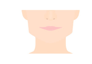 インビザライン エラ張り