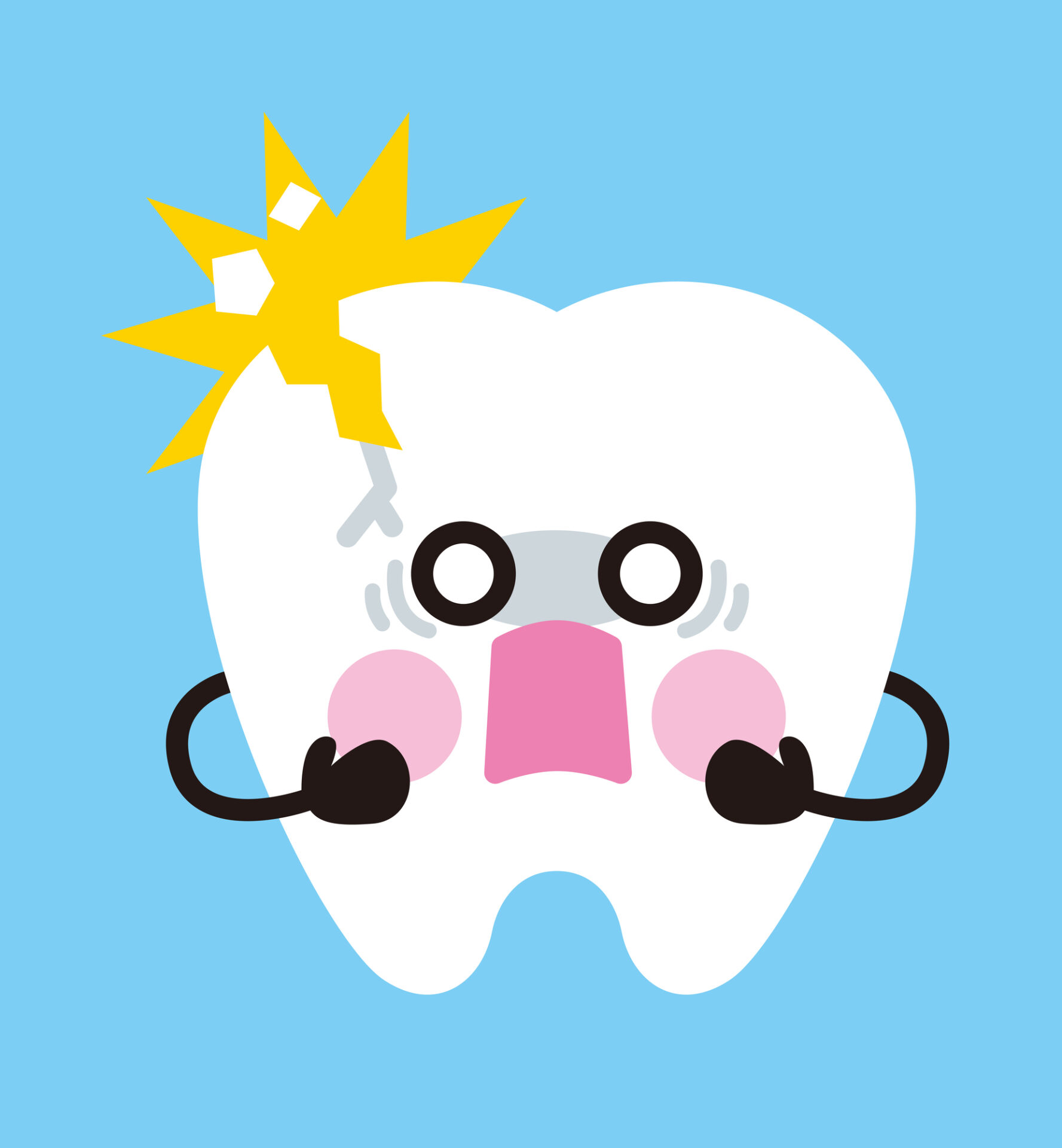 インビザライン 欠けた