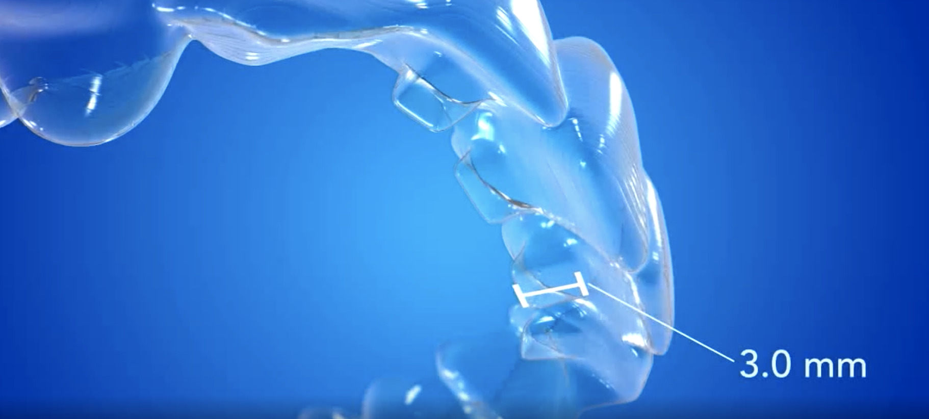 インビザライン バイトランプ