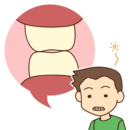 インビザライン TCH