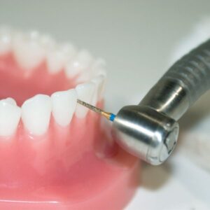 インビザライン IPR