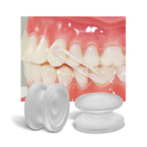 インビザライン　リンガルボタン