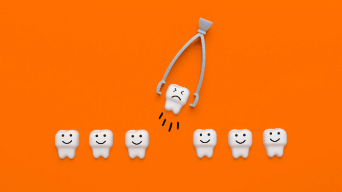 歯周病でグラグラした歯を放置する3つデメリット