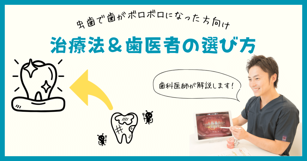 虫歯で歯がボロボロになった方向けの治療法＆歯医者の選び方
