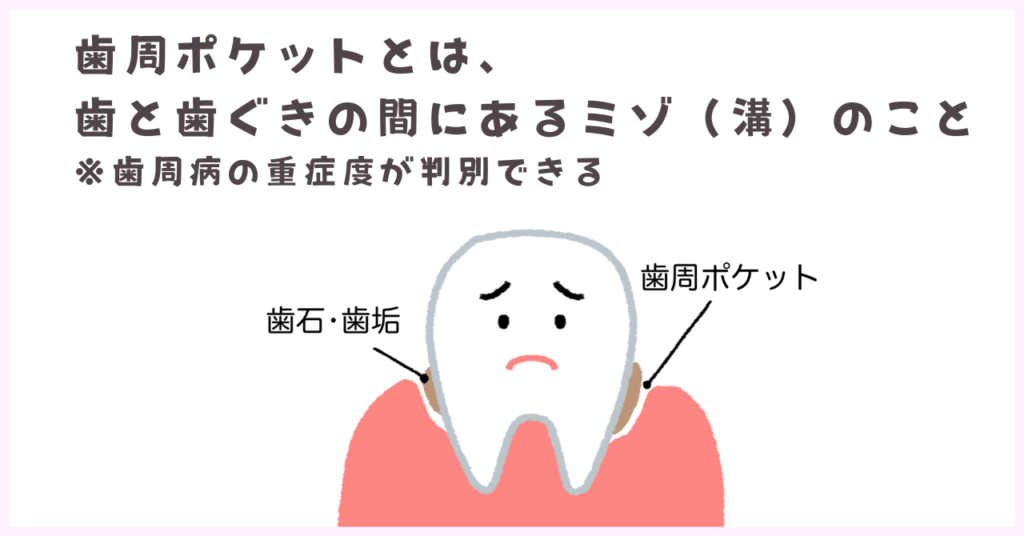 歯周ポケットとは？深いと何が危険なの？