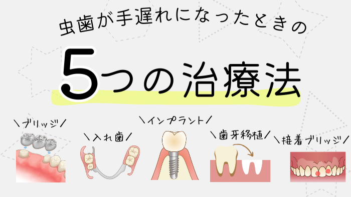 虫歯が手遅れになってしまった場合の治療法5選