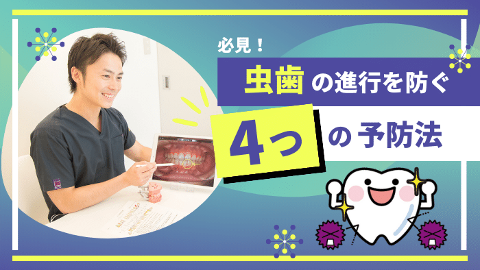 虫歯が手遅れになるのを防ぐ4つの予防法