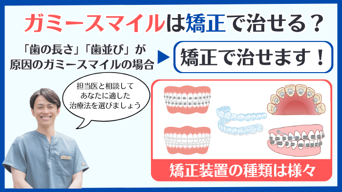 ガミースマイルは矯正で治せる？治療の種類や特徴を比較